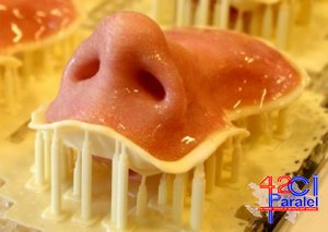 ABŞ-da 14 yaşlı oğlana 3D burun köçürülüb
