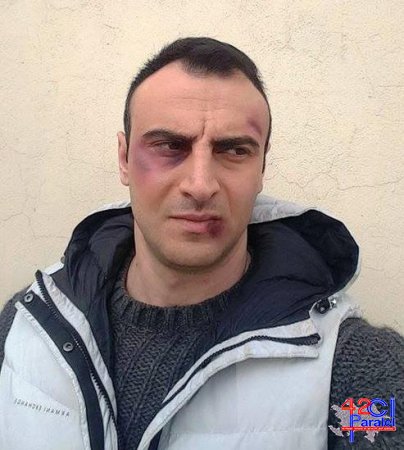Məşhur azərbaycanlı idmançı döyüldü