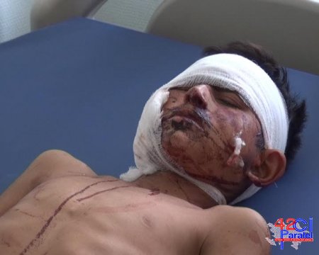 Son vaxtlar soyuq silah olan baltalanma hadisəsi çoxalmaqdadır 