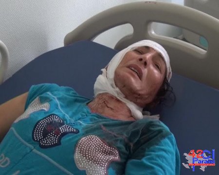 Son vaxtlar soyuq silah olan baltalanma hadisəsi çoxalmaqdadır 