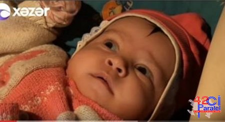 2 aylıq körpənin gözləri niyə kor oldu???.. Valideyinlər həkimi təqsirləndirirlər