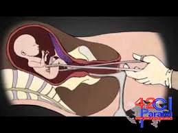 Abort zamanı narxozdan öldü - Gəncədə