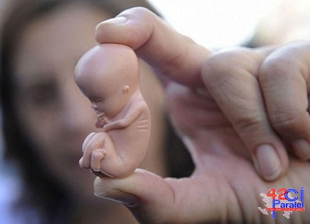Azərbaycanda aborta görə cərimələr artırılır