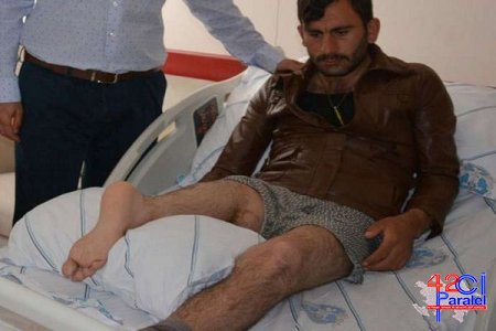 Türkiyədə qəribə hadisə: Həkimlər ayağını tərs tikdilər